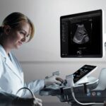 Samsung RS80A — ультразвук, который окупается быстрее, чем вы успеете сказать «диагноз»